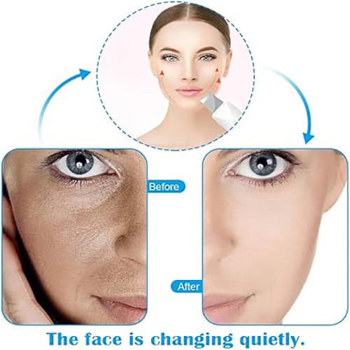 دستگاه اتوی صورت درما اف شاول